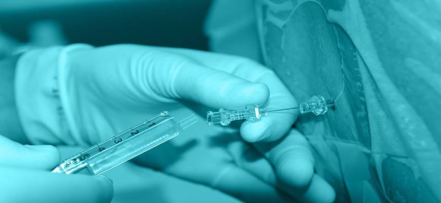 Анестезиологическое обеспечение проктологических операций